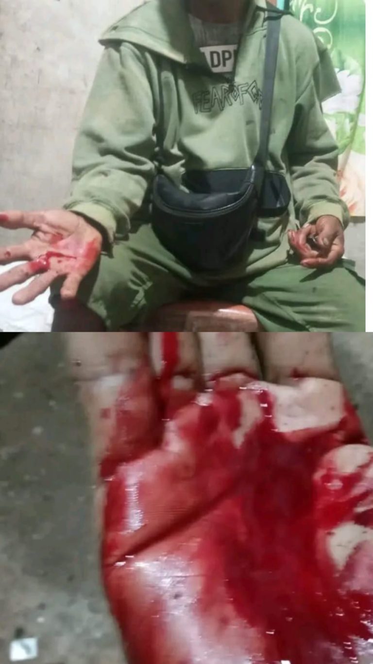 PMKRI Malaka Desak Kapolsek Laen Manen Tangkap Oknum Kades Nauke Kusa Terkait Dugaan Penganiayaan Warga